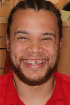 BeforeClient1 BeforeClient1