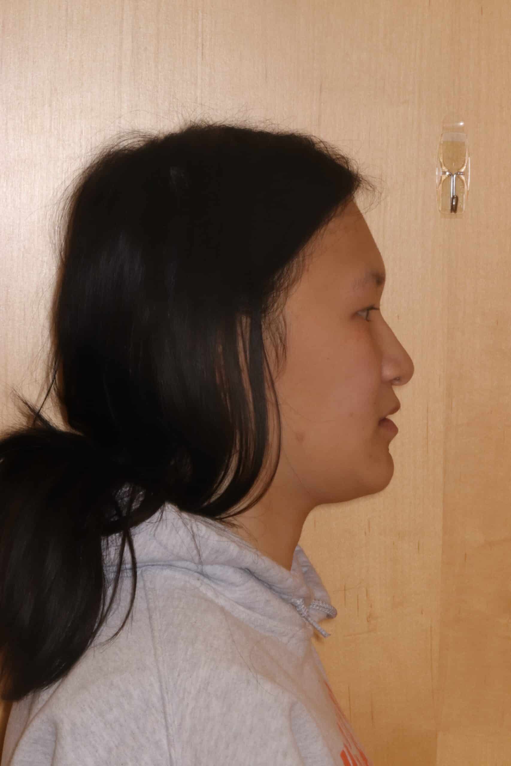 Final Photos After profile 4.21 (7)